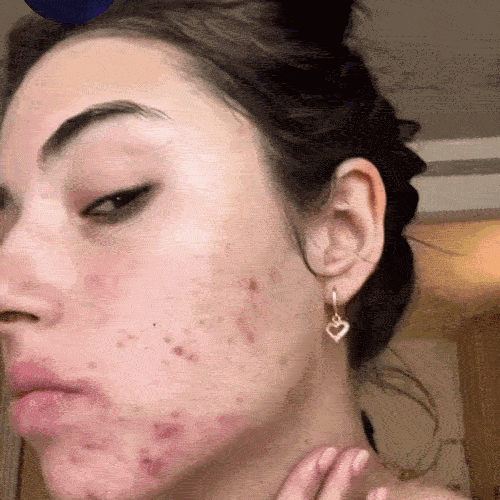 Ser Facial cu Peptide de Cupru și Acid Hialuronic
